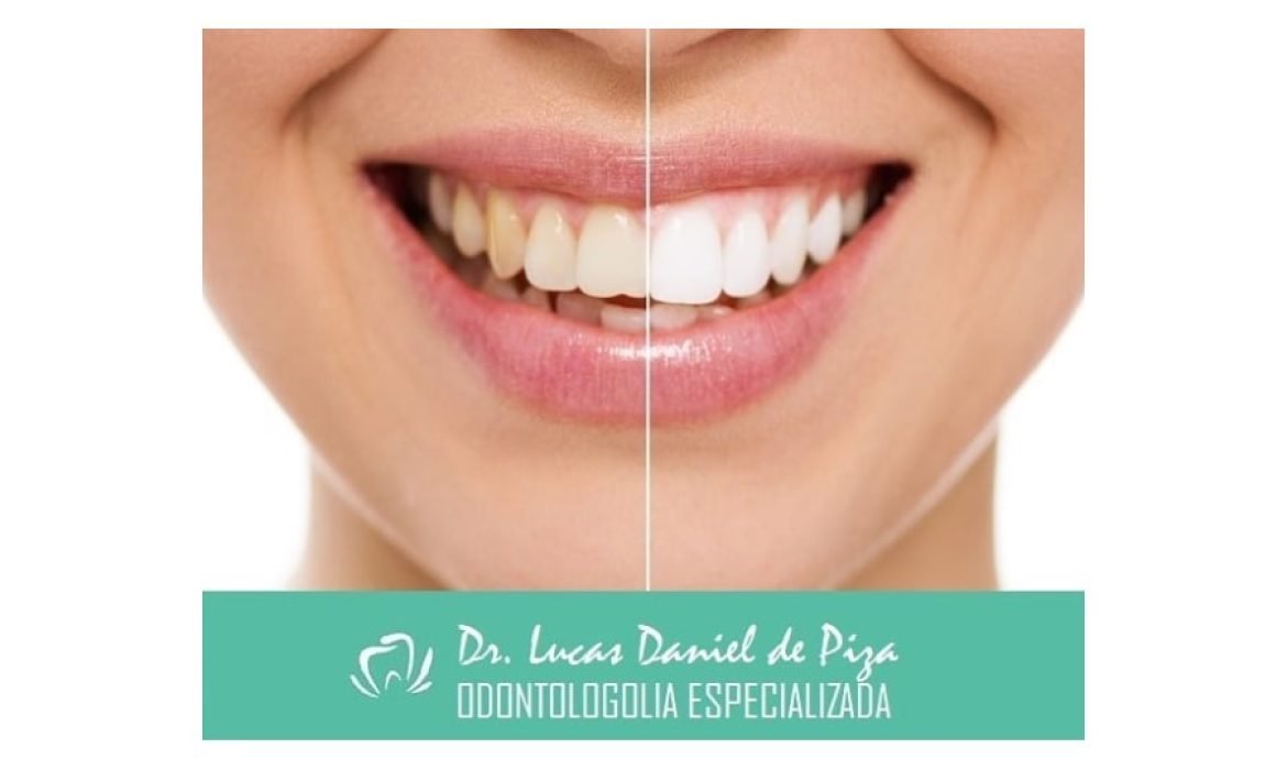 ODONTOLOGIA ESPECIALIZADA DR. LUCAS PIZA